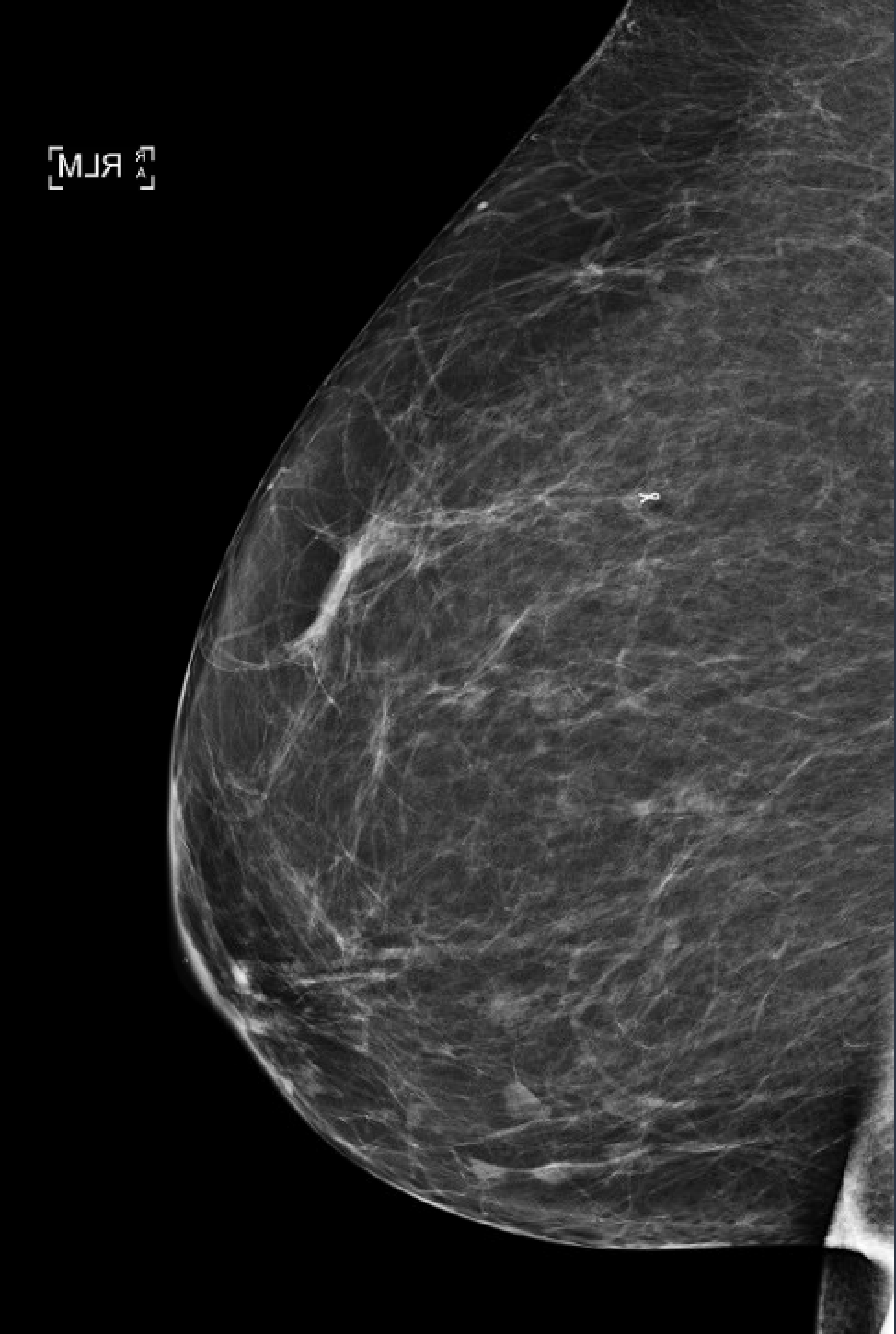 Breast Imaging