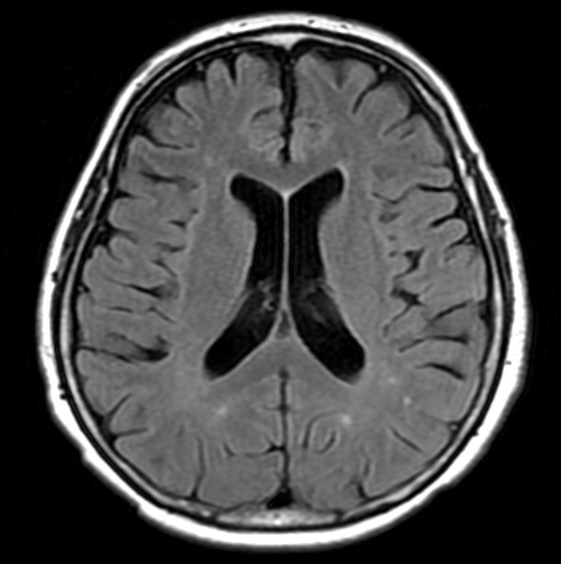 Neuroradiology