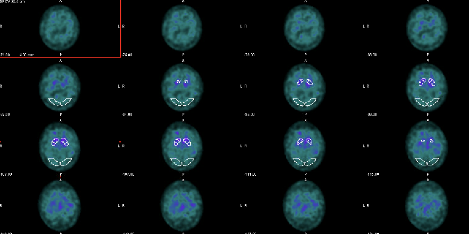 Nuclear Medicine