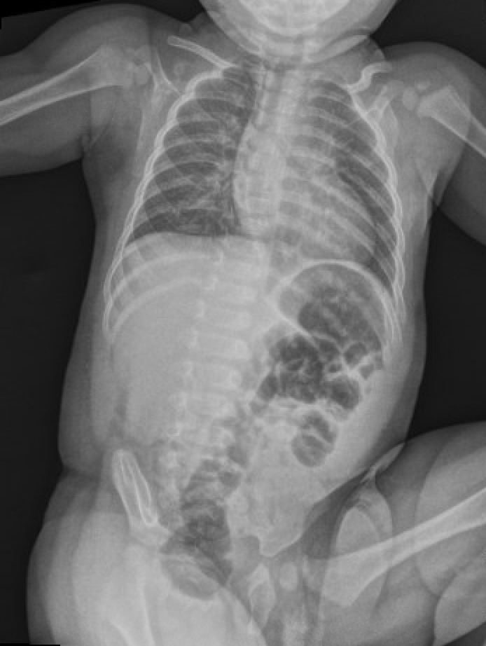 Pediatrics