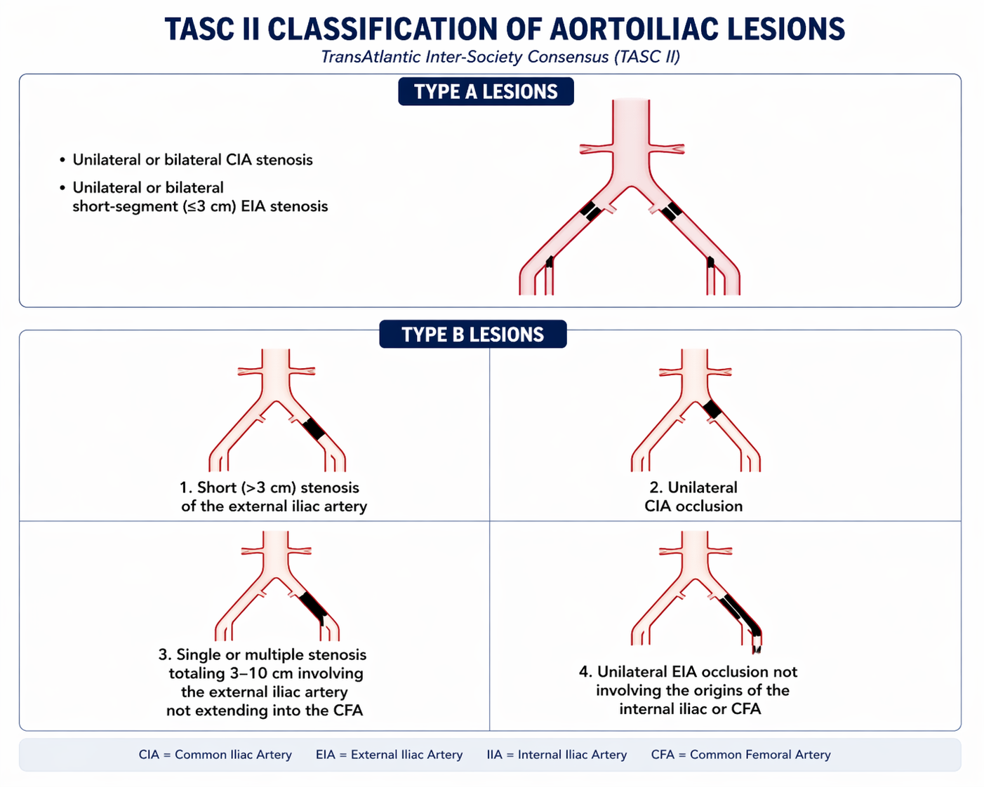 TASC II Type A and B lesion classification for SFA and popliteal artery peripheral arterial disease