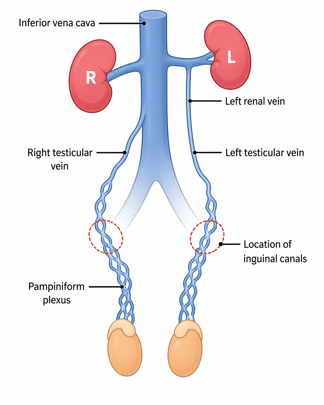 Anatomy diagram showing left and right testicular vein drainage into the left renal vein and IVC respectively