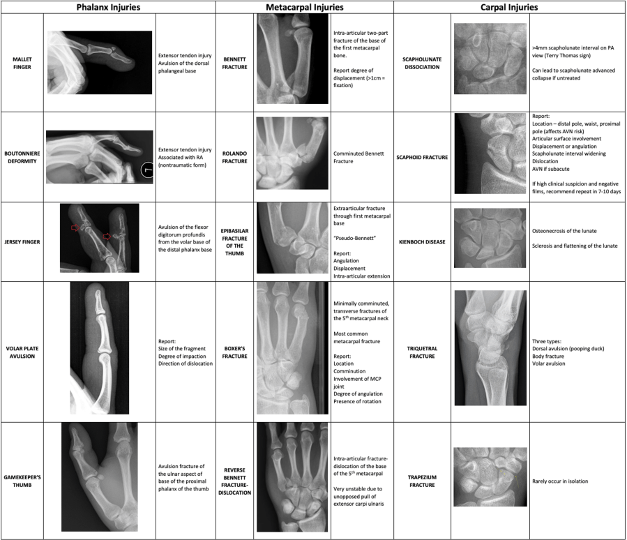 Hand and wrist injury reference — phalangeal, metacarpal, and carpal fractures with radiograph examples
