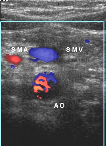 Reverse SMV/SMA orientation on ultrasound