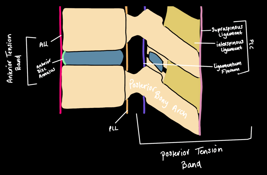 Posterior ligamentous complex anatomy — supraspinous ligament, interspinous ligament, ligamentum flavum, facet capsules, ALL, PLL, and anterior disc annulus labeled on a spinal motion segment